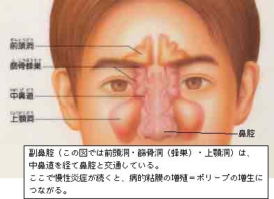 鼻炎～副鼻腔炎