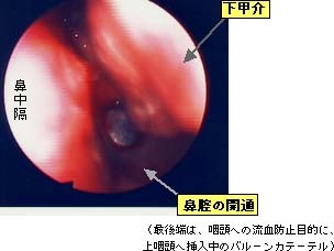 術直後